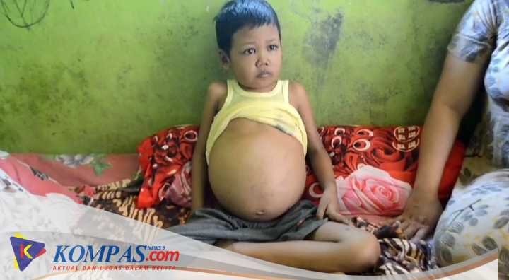Dafa Bocah 11 Tahun Asal Cikakak Sukabumi penderita Thalasemia, Harapan Uluran Tangan